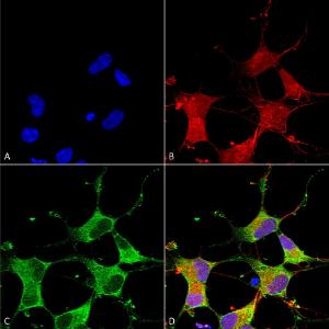 Immunocytochemistry/Immunofluorescence analysis of human neuroblastoma cells (SH-SY5Y), fixed in 4% PFA for 15 min, using Anti-GIT1 Antibody [S39B-8] (A304764), at 1:50 for overnight at 4 °C with slow rocking