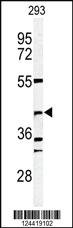 Anti-DFFB Rabbit Polyclonal Antibody