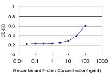 Anti-SMAD4 Mouse Monoclonal Antibody [clone: 3D7]