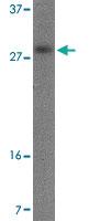 Anti-OCC1 Rabbit Polyclonal Antibody