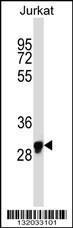 Anti-OR1N1 Rabbit Polyclonal Antibody (PE (Phycoerythrin))