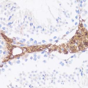 Immunohistochemistry analysis of paraffin-embedded mouse leydig cells using Anti-Vitronectin/S-Protein Antibody (A11468) at a dilution of 1:100 (40X lens)