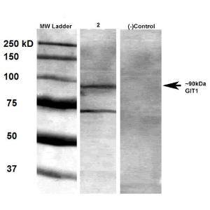 Western blot analysis of rat brain membrane lysate showing detection of GIT1 protein using Anti-GIT1 Antibody [S39B-8] (A304764) at 1:1,000