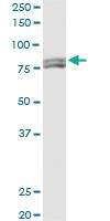 Anti-MTA1 Mouse Monoclonal Antibody [clone: 2D4]