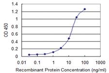 Anti-PICK1 Mouse Monoclonal Antibody [clone: 3G5]