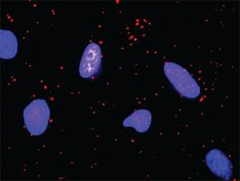 Anti-KITLG + FLT3LG Antibody Pair