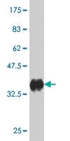 Anti-CDC42BPB Mouse Monoclonal Antibody [clone: 6G3]