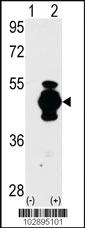 Anti-GFAP Rabbit Polyclonal Antibody