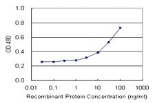 Anti-RRM2 Antibody Pair