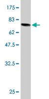 Anti-FH Mouse Monoclonal Antibody [clone: 5C12]