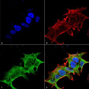 Immunocytochemistry/Immunofluorescence analysis of human neuroblastoma cell line (SK-N-BE, fixed in 4% formaldehyde for 15 min at room temperature, using Anti-GIT1 Antibody [S39B-8] (A304764), at 1:100 for 60 minutes at room temperature