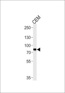 Anti-MYB Mouse Monoclonal Antibody [clone: 1279CT309.289]