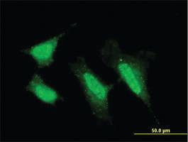 Anti-PRKCI Mouse Monoclonal Antibody [clone: 1G11]