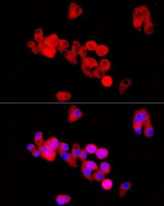 Immunofluorescence analysis of HepG2 cells using Anti-Kininogen 1 Antibody (A11469) at a dilution of 1:50 (40x lens). DAPI was used to stain the cell nuclei (blue).