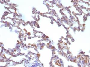 Immunohistochemical analysis of formalin-fixed, paraffin-embedded rat lung using Anti-Moesin Antibody [MSN/491]