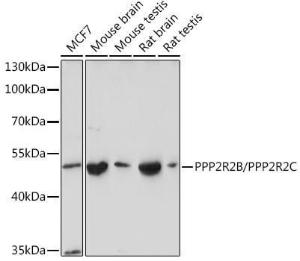 Western blot analysis of extracts of various cell lines, using Anti-PPP2R2B + PPP2R2C Antibody (A305966) at 1:1000 dilution