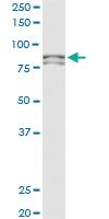 Anti-MTA1 Mouse Monoclonal Antibody [clone: 2D4]