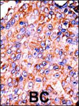 Anti-STAT3 Rabbit Polyclonal Antibody (FITC (Fluorescein))