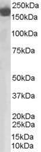 Anti-CFH Antibody (A82643) staining (0.03µg/ml) of Human Lung lysate (RIPA buffer, 35µg total protein per lane). Primary incubated for 1 hour. Detected by chemiluminescence.