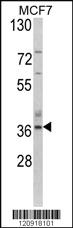 Anti-ZSWIM5 Rabbit Polyclonal Antibody