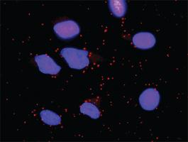 Anti-CCNB1 + FOXO1 Antibody Pair