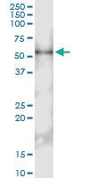 Anti-IL13RA2 Polyclonal Antibody Pair