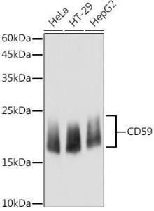 Anti-CD59 antibody