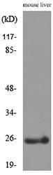 Anti-C Reactive Protein Rabbit Polyclonal Antibody