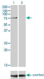 Anti-PRKCI Mouse Monoclonal Antibody [clone: 1G11]