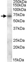 Anti-ABCD3 Goat Polyclonal Antibody