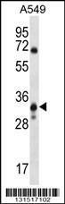 Anti-SLC25A53 Rabbit Polyclonal Antibody (APC (Allophycocyanin))