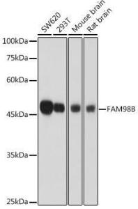 Western blot analysis of extracts of various cell lines, using Anti-FAM98B Antibody (A307689) at 1:1,000 dilution