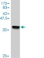 Anti-FHIT Mouse Polyclonal Antibody