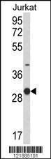 Anti-KLRC1 Rabbit Polyclonal Antibody (Biotin)