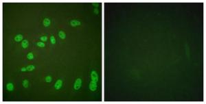 Immunofluorescence analysis of HeLa cells, treated with PMA 125ng/ml 30', using Anti-POLR2A (phospho Ser1619) Antibody. The right hand panel represents a negative control, where the antibody was pre-incubated with the immunising peptide