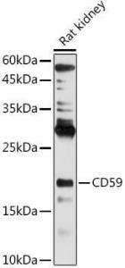 Anti-CD59 antibody