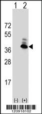 Anti-ZSWIM5 Rabbit Polyclonal Antibody