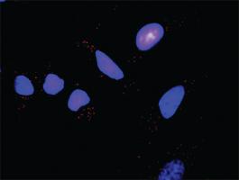 Anti-IKBKB + FOXO3 Antibody Pair