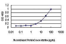 Anti-PRKCI Mouse Monoclonal Antibody [clone: 1G11]