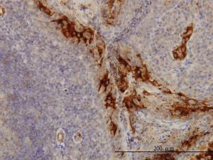 Anti-TNFRSF6B Mouse Monoclonal Antibody [clone: 7G5]