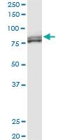 Anti-MTA1 Mouse Monoclonal Antibody [clone: 2D4]