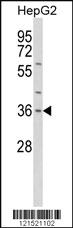 Anti-UGT2B11 Rabbit Polyclonal Antibody