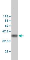 Anti-FHIT Mouse Monoclonal Antibody [clone: 1A2]