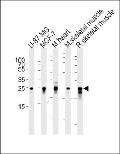 Anti-CRYAB Mouse Monoclonal Antibody [clone: 1329CT523.140.120]