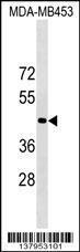 Anti-OR1N2 Rabbit Polyclonal Antibody (HRP (Horseradish Peroxidase))