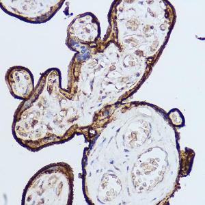 Anti-CD59 antibody