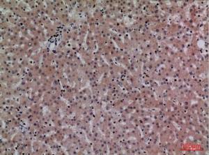 Anti-C Reactive Protein Rabbit Polyclonal Antibody