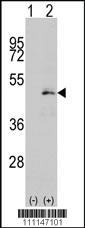 Anti-MAP2K1 Rabbit Polyclonal Antibody