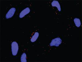 Anti-PRKCD + FYN Antibody Pair