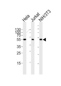 Anti-PPARA Mouse Monoclonal Antibody [clone: 1331CT894.186.143]